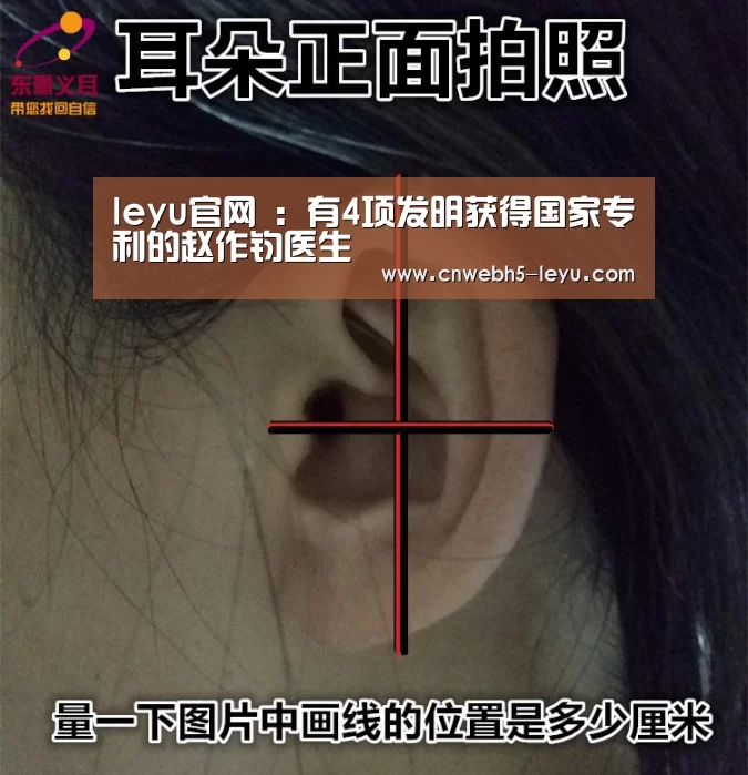 leyu官网 :有4项发明获得国家专利的赵作钧医生(图1) 登录入口